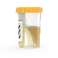 full image TUBYCON Single Tube Urine Test Cup Kit