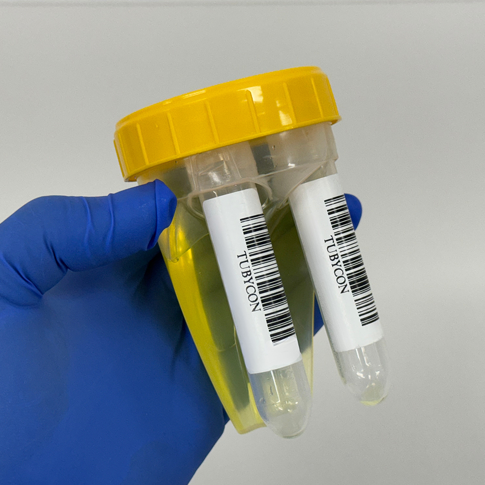 TUBYCON Dual Tube Urine Test Cup Kit
